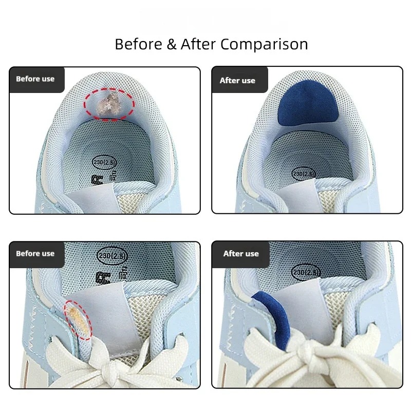 6 Buah Stiker Perbaikan Sepatu - Life Sneaker Care ulasan dan harga